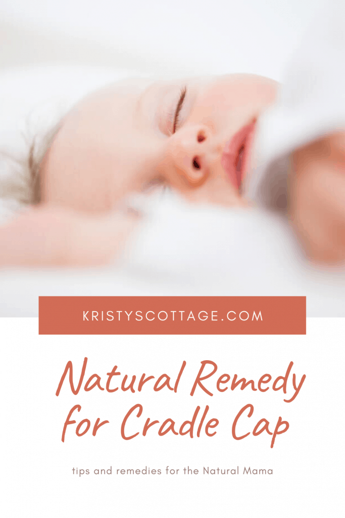 Looking for a natural remedy for cradle cap? Here are natural remedies and natural living tips that worked for my babies.